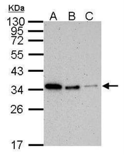 PCNA Antibody (339), Novus Biologicals 0.1mg; Unlabeled:Antibodies, Monoclonal