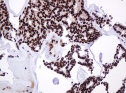 PCNA Antibody (OTI3D6), Novus Biologicals 0.1mL; Unlabeled:Antibodies,