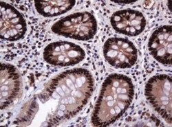 PCNA Antibody (OTI3D6), Novus Biologicals 0.1mL; Unlabeled:Antibodies,