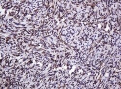 PCNA Antibody (OTI3D6), Novus Biologicals 0.1mL; Unlabeled:Antibodies,