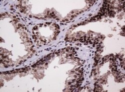 PCNA Antibody (OTI3D6), Novus Biologicals 0.1mL; Unlabeled:Antibodies,