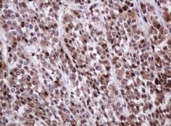 PCNA Antibody (OTI3D6), Novus Biologicals 0.1mL; Unlabeled:Antibodies,