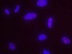 PCNA Antibody, Novus Biologicals 0.1mL; Unlabeled:Antibodies, Polyclonal