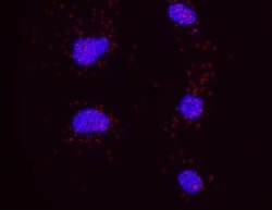 PCNA Antibody, Novus Biologicals 0.1mL; Unlabeled:Antibodies, Polyclonal