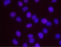 PCNA Antibody, Novus Biologicals 0.1mL; Unlabeled:Antibodies, Polyclonal