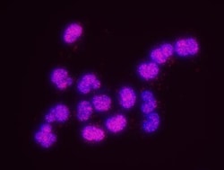 PCNA Antibody, Novus Biologicals 0.1mL; Unlabeled:Antibodies, Polyclonal
