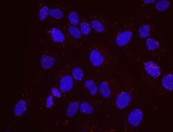 PCNA Antibody, Novus Biologicals 0.1mL; Unlabeled:Antibodies, Polyclonal