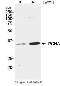 PCNA Antibody, Novus Biologicals 0.1mL; Unlabeled:Antibodies, Polyclonal