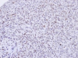 PCNP Antibody, Novus Biologicals 100 &mu;L | Buy Online | Novus Biologicals | Fisher Scientific