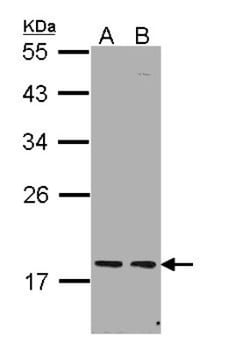 PCNP Antibody, Novus Biologicals 100 &mu;L | Buy Online | Novus Biologicals | Fisher Scientific