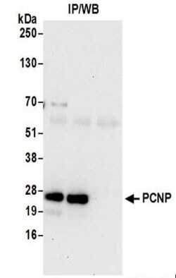 PCNP Antibody, Novus Biologicals 0.1mL:Antibodies, Polyclonal