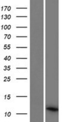 Novus Biologicals&trade;&nbsp;PCOTH Overexpression Lysate