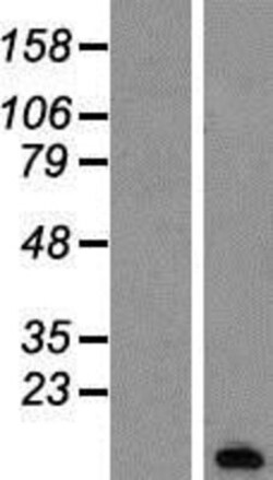 Novus Biologicals&trade;&nbsp;PCP4 Overexpression Lysate