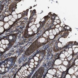 PCPTP1 Antibody, Novus Biologicals:Antibodies:Primary Antibodies