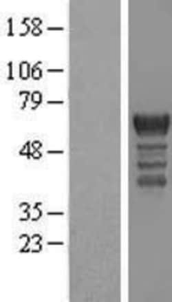 Novus Biologicals&trade;&nbsp;PCTAIRE1 Overexpression Lysate