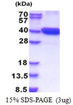 Novus Biologicals&trade;&nbsp;Recombinant Human PCTAIRE1 His Protein