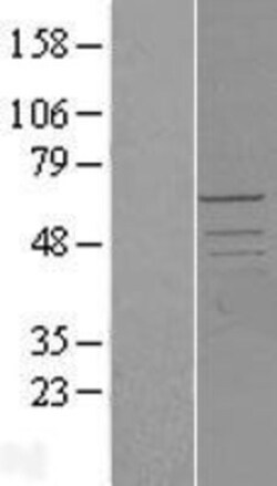 Novus Biologicals&trade;&nbsp;PCTAIRE2 Overexpression Lysate