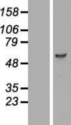 Novus Biologicals&trade;&nbsp;PCTAIRE3 Overexpression Lysate
