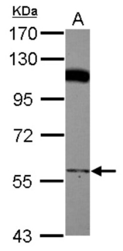 PCYOX1 Antibody, Novus Biologicals 0.1mL; Unlabeled:Antibodies, Polyclonal