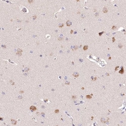 PCYOX1L Antibody, Novus Biologicals 0.1mL; Unlabeled:Antibodies, Polyclonal
