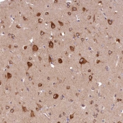 PCYOX1L Antibody, Novus Biologicals 0.1mL; Unlabeled:Antibodies, Polyclonal