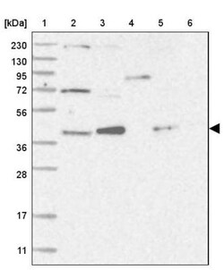PCYT1A Antibody, Novus Biologicals:Antibodies:Primary Antibodies