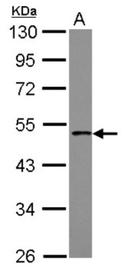 anti-PCYT1B, Polyclonal, Novus Biologicals 0.1mL; Unlabeled:Antibodies,