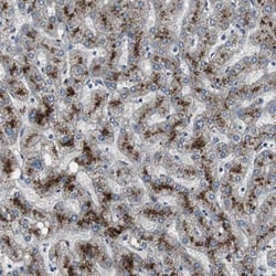MECR Antibody, Novus Biologicals:Antibodies:Primary Antibodies