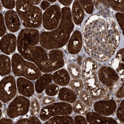 PCYT2 Antibody, Novus Biologicals 0.1 mL | Buy Online | Novus Biologicals | Fisher Scientific