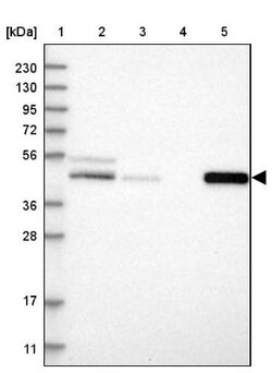 PCYT2 Antibody, Novus Biologicals 0.1 mL | Buy Online | Novus Biologicals | Fisher Scientific