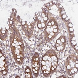 PDAP1 Antibody, Novus Biologicals 0.1mL; Unlabeled:Antibodies, Polyclonal