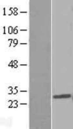 Novus Biologicals&trade;&nbsp;PDCD10 Overexpression Lysate