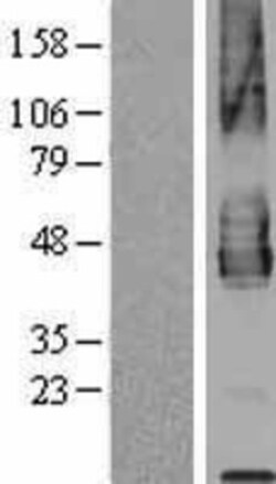 Novus Biologicals™ PD-L2/B7-DC/PDCD1LG2 Overexpression Lysate