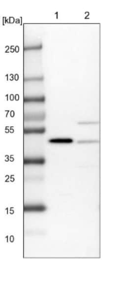 PDCD2 Antibody, Novus Biologicals 0.1mL; Unlabeled:Antibodies, Polyclonal