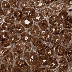 PDCD2 Antibody, Novus Biologicals 0.1mL; Unlabeled:Antibodies, Polyclonal