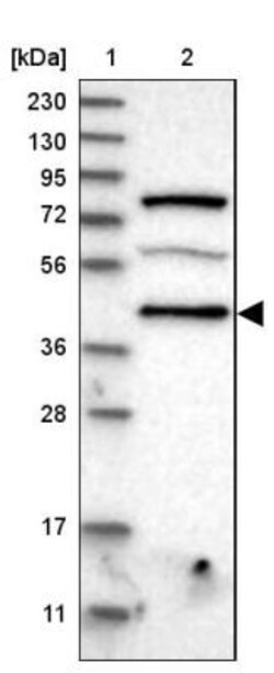 PDCD2 Antibody, Novus Biologicals 0.1mL; Unlabeled:Antibodies, Polyclonal