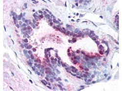 PDCD4, p Ser457 Antibody, Novus Biologicals 0.1mg; Unlabeled:Antibodies,