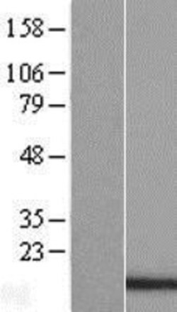 Novus Biologicals&trade;&nbsp;PDCD5 Overexpression Lysate