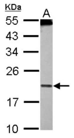 PDCD6 Antibody, Novus Biologicals 0.1mL; Unlabeled:Antibodies, Polyclonal