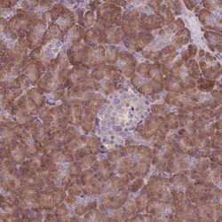 PDCL2 Antibody, Novus Biologicals:Antibodies:Primary Antibodies