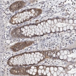 PDCL3 Antibody, Novus Biologicals 25 &mu;L; Unlabeled:Antibodies, Polyclonal