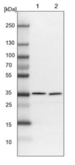 PDCL3 Antibody, Novus Biologicals 25 &mu;L; Unlabeled:Antibodies, Polyclonal