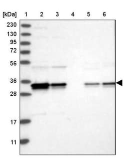 PDCL3 Antibody, Novus Biologicals 25 &mu;L; Unlabeled:Antibodies, Polyclonal