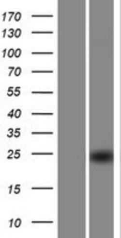 Novus Biologicals&trade;&nbsp;PDDC1 Overexpression Lysate