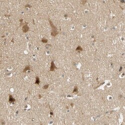 PDDC1 Antibody, Novus Biologicals 0.1mL; Unlabeled:Antibodies, Polyclonal