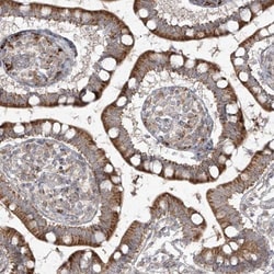 PDE11A Antibody, Novus Biologicals 0.1mL; Unlabeled:Antibodies, Polyclonal