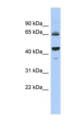 PDE12 Antibody, Novus Biologicals 0.05mg; Unlabeled:Antibodies, Polyclonal