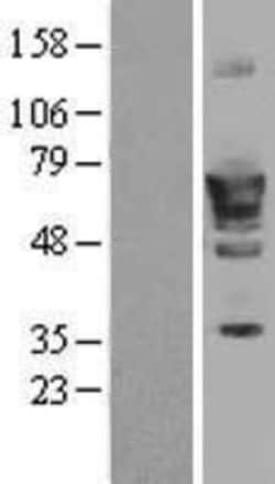 Novus Biologicals™ PDE1B Overexpression Lysate