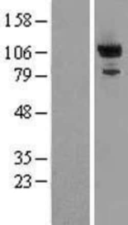 Novus Biologicals&trade;&nbsp;PDE2A Overexpression Lysate