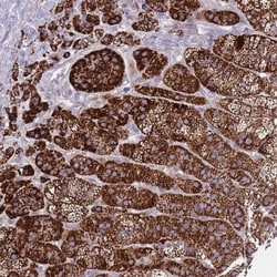 Phosphodiesterase 4A/PDE4A Antibody, Novus Biologicals:Antibodies:Primary